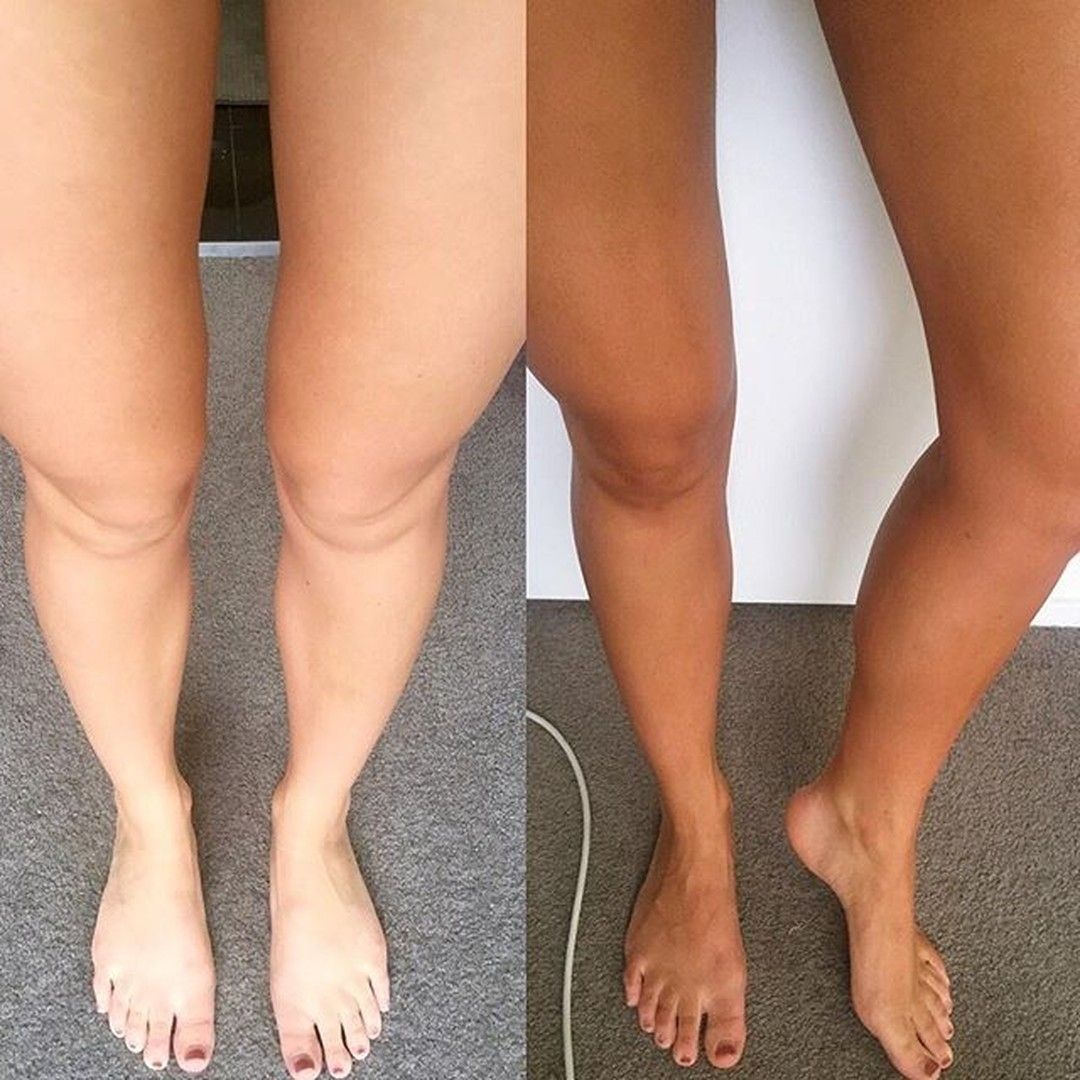 Dark Self Tan Mousse